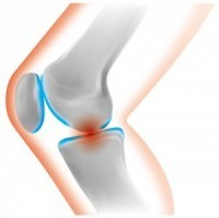 膝痛の原因